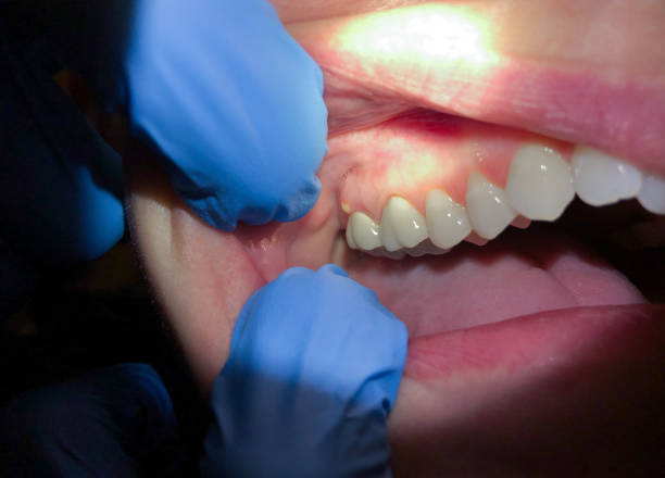 Best Cracked Tooth Emergency Dentist  in Wayne City, IL