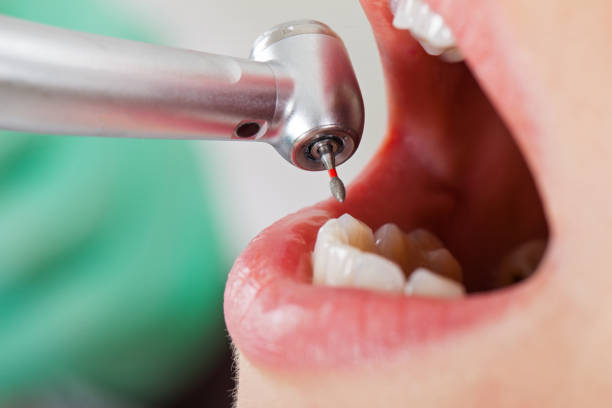Best Root Canal Emergency Dentist  in Wayne City, IL
